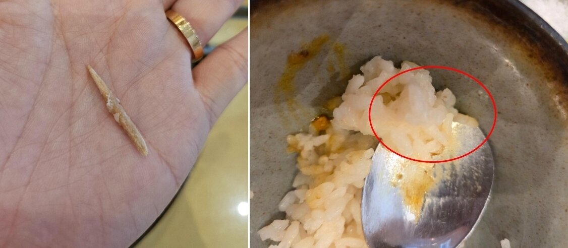 본문 이미지 - 제보자 A 씨가 식사도중 발견한 이쑤시개. 출처=보배드림