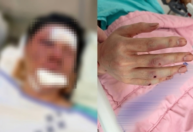 "내 아들, 누굴 모질게 패는 독한 애 아냐"…유튜버 수탉 납치범 모친의 항변