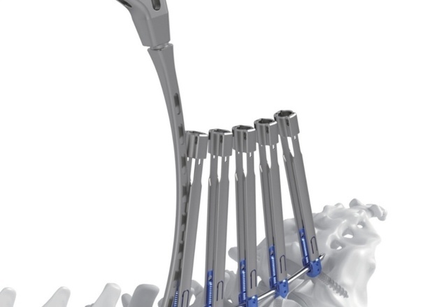 메드트로닉코리아, 신규 척추 포트폴리오 '강휘' 출시