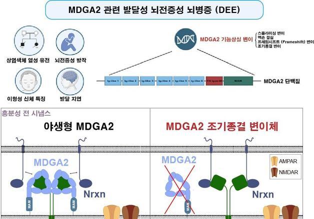 "중증 뇌전증 원인은 뇌 흥분 조절 '브레이크' 고장 때문"