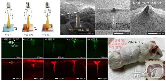본문 이미지 - 전기방사 웹 마이크로 니들의 제작 결과 및 약물 전달 결과(기계연 제공) /뉴스1