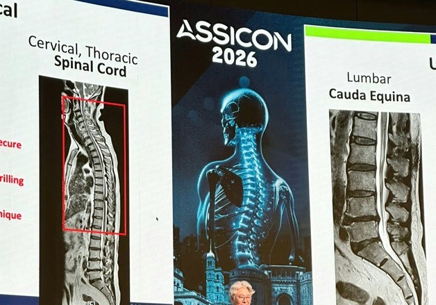 대전우리병원 박철웅 원장, 인도 척추외과학회 학술대회 참석해 강연