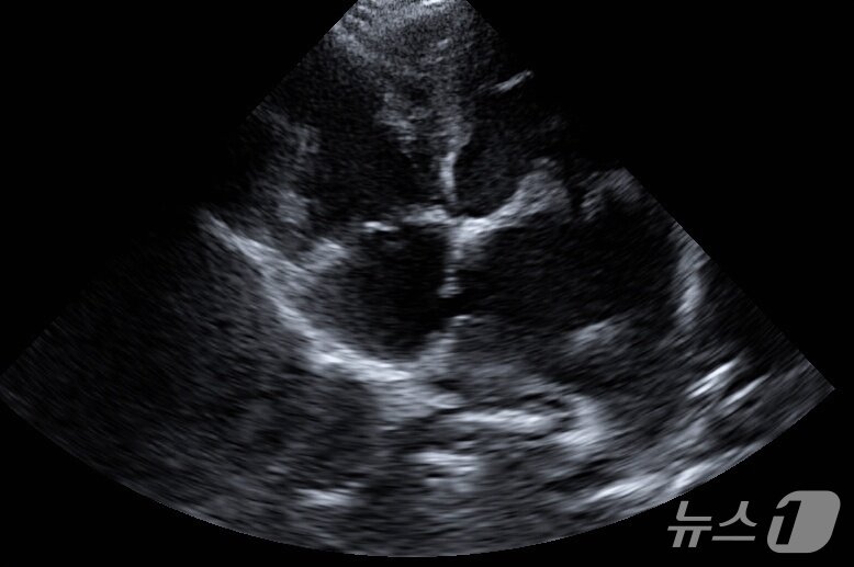 본문 이미지 - 강아지 초음파 검사 결과 심방중격 부위가 터진 모습(더케어동물의료센터 제공) ⓒ 뉴스1
