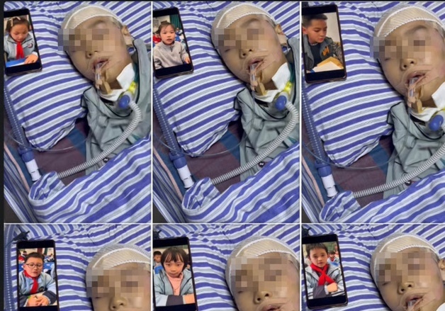 교통사고로 '55일간 혼수' 8살 소년…"눈 떠봐" 친구들 소리에 의식 찾았다