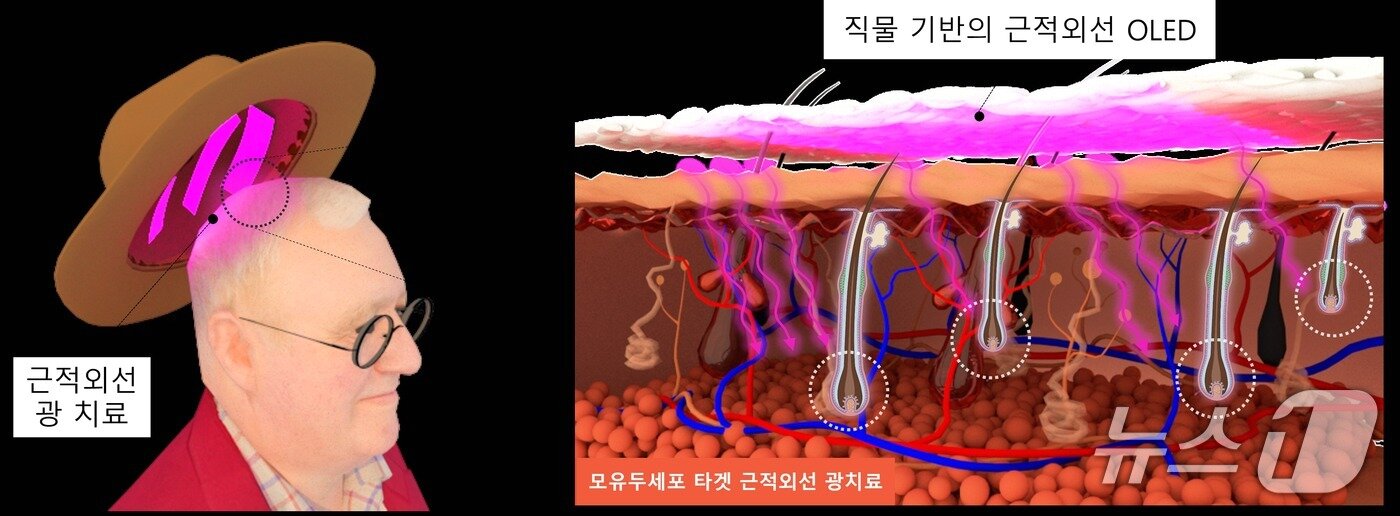 본문 이미지 - 직물 기반 근적외선 OLED 모자를 이용한 광 치료 모식도(KAIST 제공) /뉴스1