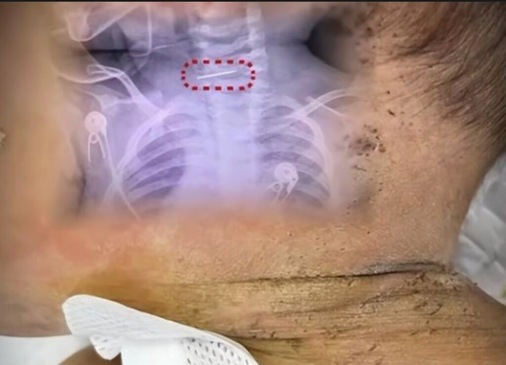 본문 이미지 - (SCMP 갈무리)