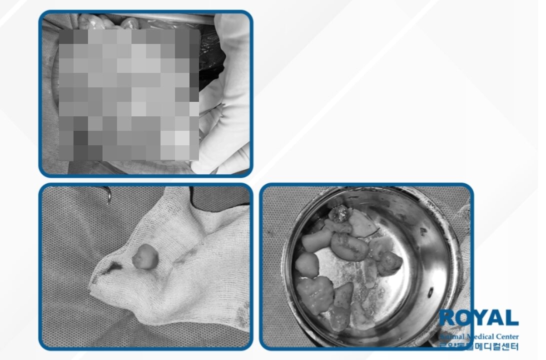 본문 이미지 - 포메라니안 위와 장에서 발견된 브라질너트(로얄동물메디컬센터 제공) ⓒ 뉴스1