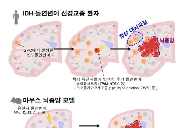 난치성 뇌종양 '기원세포' 찾았다…조기 진단·재발 억제 치료 새 지평