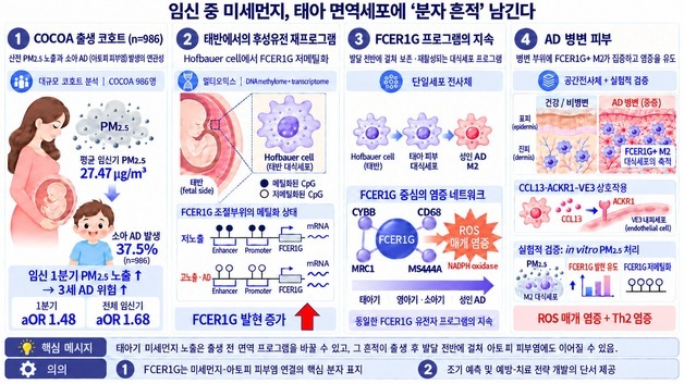 경희대 연구팀 "임신 초기 미세먼지 노출, 아토피 위험과 연결"