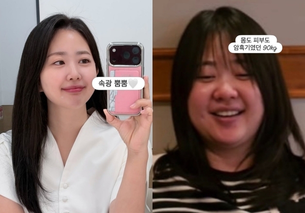 '박수홍♥' 김다예, 90㎏ 시절 공개…확 달라진 청순 미모 [N샷]