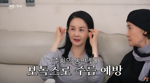 '임요한♥' 54세 김가연, 최강동안 유지 비결은…"관자놀이와 미간에 보톡스"