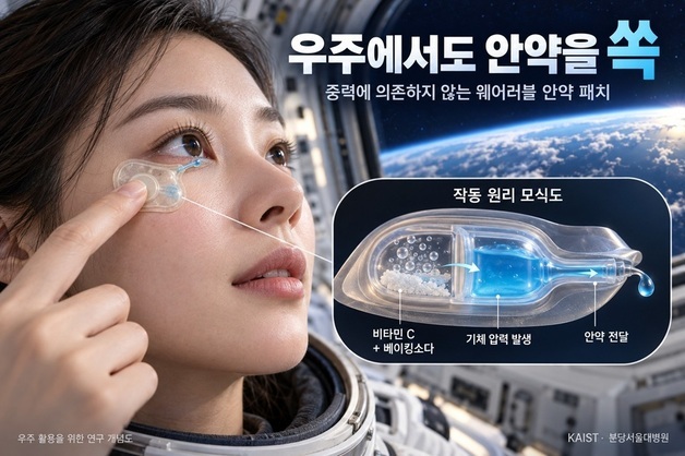 우주에서도 안약 '쏙'…중력 필요 없는 웨어러블 안약 패치 개발