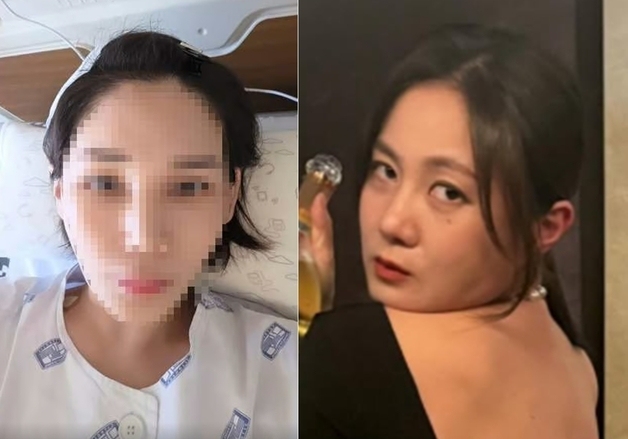 "머리 10㎝ 찢어지고 피 흥건, 뵈는 게 없다" 박나래 '주사 이모' 무슨 일?