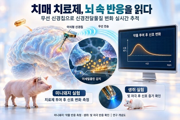 치매 치료제 투여 후 뇌 속 변화 무선 신경칩으로 실시간 추적