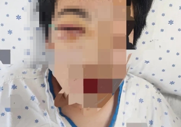"학폭 가해자들, 졸업 잘 시켜 보디가드로 쓰면 돼"…교장 말에 분노
