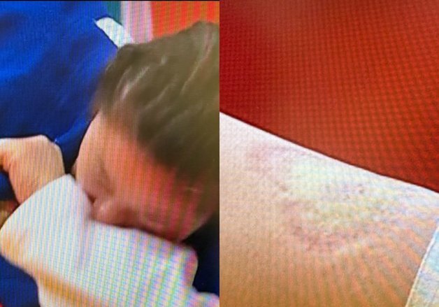 日 선수 팔 문 中 선수의 황당 해명…"입이 어쩌다 부딪혔을 뿐"[AG]