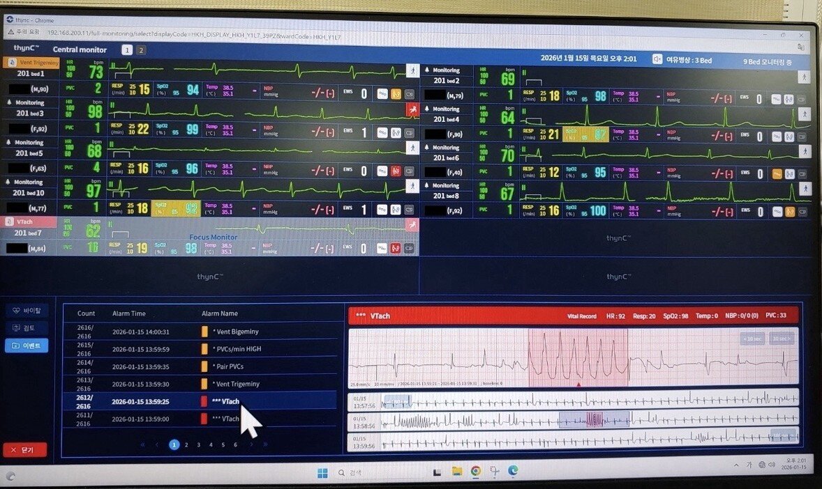 본문 이미지 - 씽크(thynC) 원격 모니터링 화면에 심실빈맥이 감지된 모습.(대웅제약 제공)/뉴스1