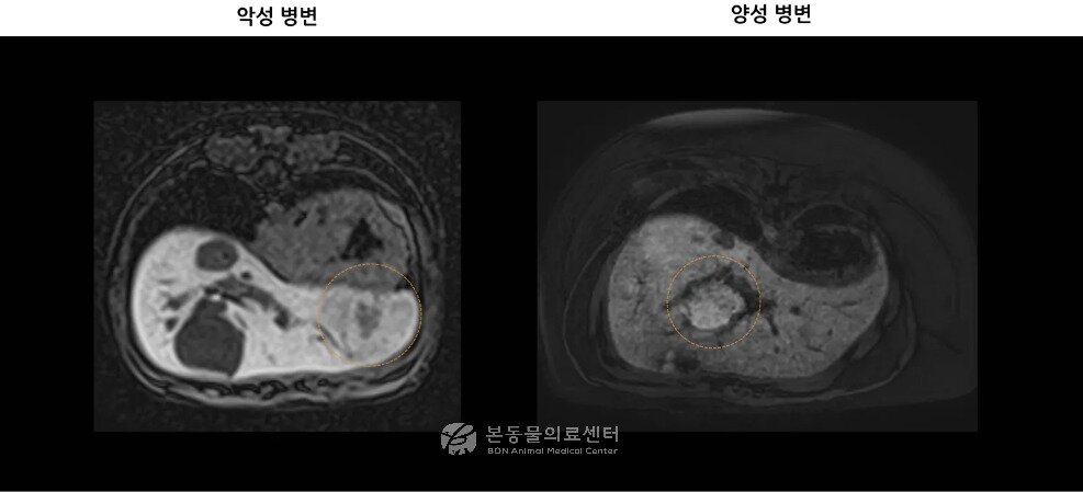 본문 이미지 - 초음파와 CT 검사에서 간 결절이 발견돼 매우 비슷한 소견을 보인 두 환견의 MRI 검사 결과. 한 환견은 악성 종양, 다른 환견은 양성으로 진단됐다(본동물의료센터 제공). ⓒ 뉴스1