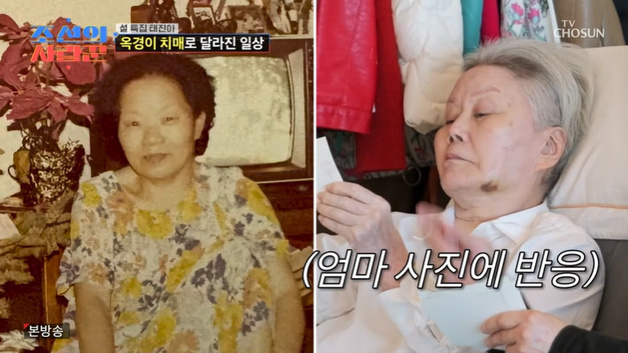 '태진아♥' 옥경이, 치매에도 母 사진에 반응…"아파요"
