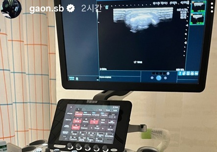 '절뚝이며 금메달' 스노보드 최가온, 세 군데 골절 진단[올림픽]