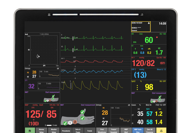GE헬스케어 환자 통증 정량화 지표 'SPI' 신의료기술 등재