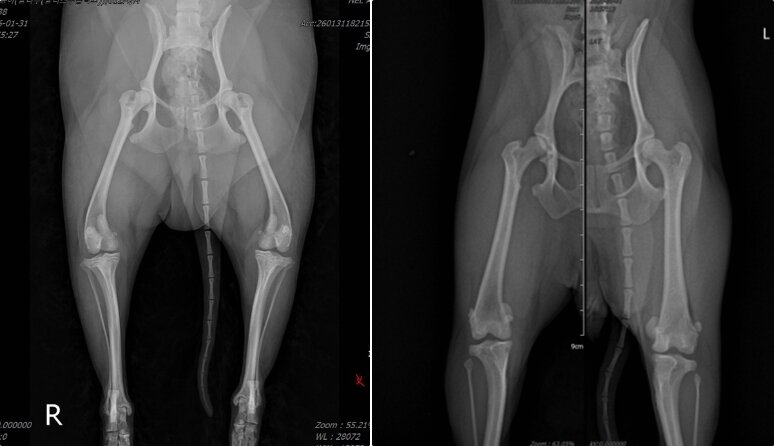 본문 이미지 - 왼쪽처럼 촬영 시 무릎뼈(슬개골)와 허벅지뼈가 안쪽으로 돌아가 각도 측정이 어렵다. 오른쪽 사진처럼 허벅지뼈 정렬을 맞춰 촬영해야 변형 정도와 수술 위치를 정밀하게 확인할 수 있다(바르고바르개 제공). ⓒ 뉴스1