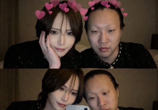 "이성에 잘 보이기 아닌 나를 위한 선택"…'성형 전후' 인증 사진 공개 붐