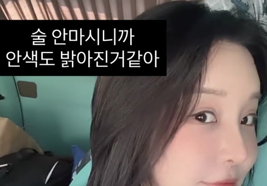 랄랄, 코 성형수술에 다이어트까지…물오른 비주얼 "3㎏ 감량" [N샷]