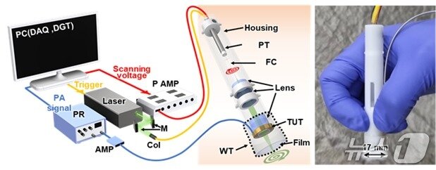본문 이미지 - 수술실이나 응급 현장에서 사용할 수 있는 볼펜 크기의 광·음향 현미경.(포스텍 제공, 재판매 및 DB금지) 2026.2.26/뉴스1 
