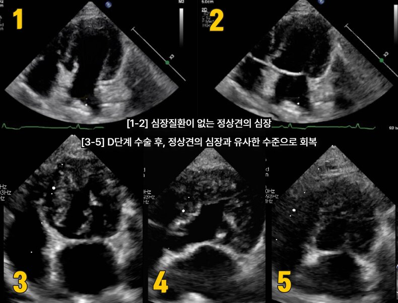 본문 이미지 - D단계 수술 후, 정산견의 심장과 유사한 수준으로 회복된 반려견의 심장초음파(넬동물의료센터 제공) ⓒ 뉴스1