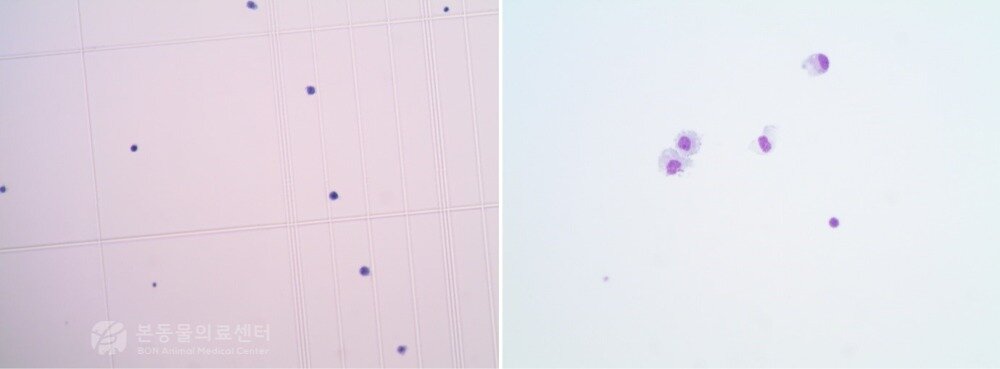 본문 이미지 - 뇌척수액 검사 결과 유핵세포 수가 증가된 모습(왼쪽)과 유핵세포 대부분이 단핵세포로 구성돼 있는 모습. 이는 비감염성 염증성 질환에서 흔히 보이는 패턴이다(본동물의료센터 제공). ⓒ 뉴스1
