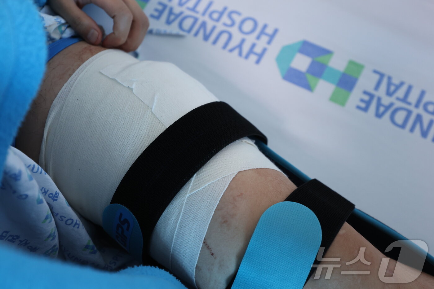 본문 이미지 - 지난 2일 광주 서구 금호동에서 도주 중인 강도를 맨몸으로 제압하던 중 흉기에 찔린 김세웅 씨(28)의 왼쪽 허벅지 상처. 깊이 약 6~7cm로, 현재 봉합 수술을 앞두고 있다. ⓒ News1 박지현 기자