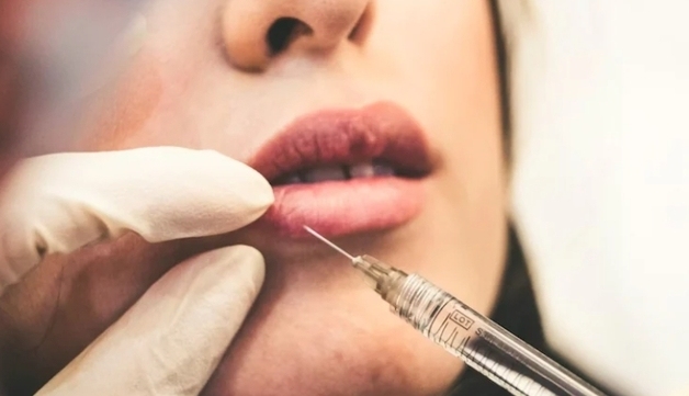 장기 기증도 아닌데…시신 지방으로 가슴·엉덩이 시술받는 뉴욕커들