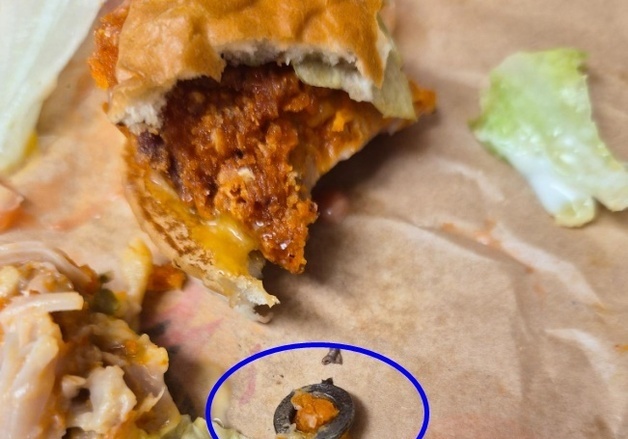 "버X킹서 나온 금속 볼트에 앞니 깨져…일주일 뒤 본사 답변 '원인불상'"