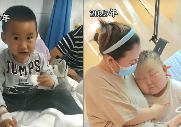 '항암 17번·골수이식 2번' 백혈병 투병 10세 소년 사망…60만 팔로워 애도