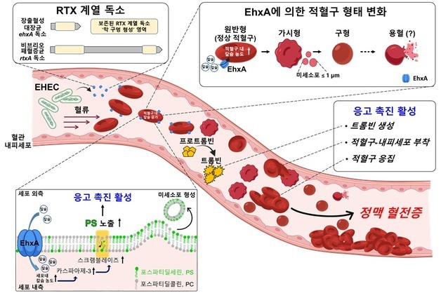장출혈성 대장균의 '숨은 공범' 찾았다…혈전 합병증 새 경로 규명