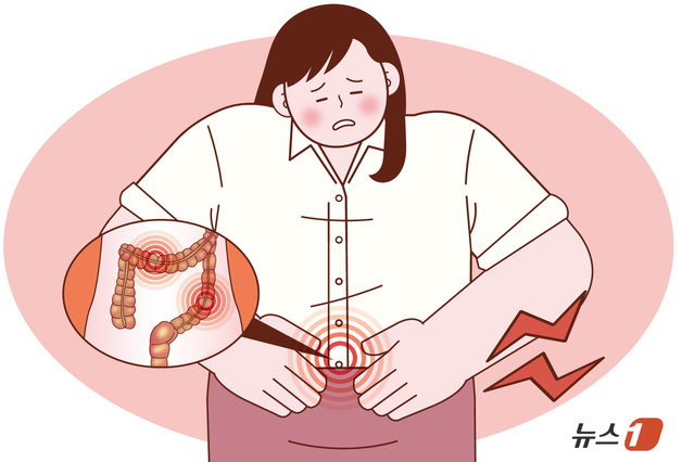 [100세건강] 젊은층 노리는 '크론병'…배탈로 여겨 방치하기 일쑤