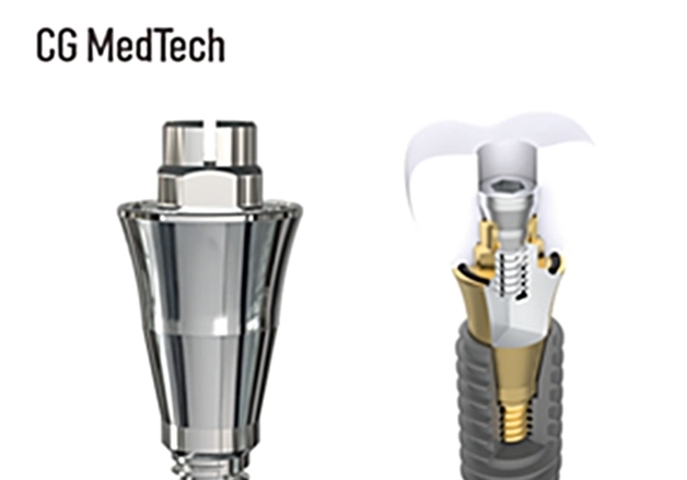 시지메드텍, 치과 임플란트 보철 신제품 '우루덴트 SA' 출시