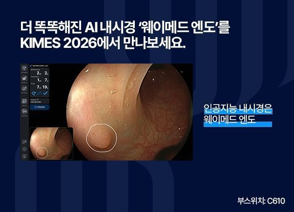 본문 이미지 - 웨이메드 엔도 소개 자료. (웨이센 제공) 