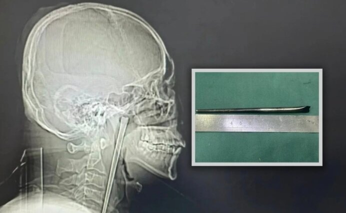 본문 이미지 - 사우스차이나모닝포스트