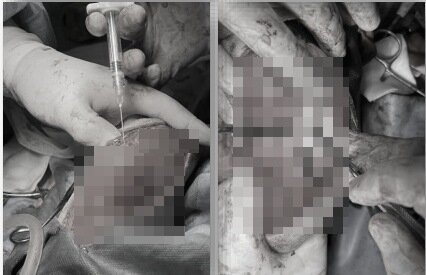 본문 이미지 - TPLO 수술 시 관절주사 애니콘주 적용하는 모습(왼쪽, 로얄동물메디컬센터 제공) ⓒ 뉴스1