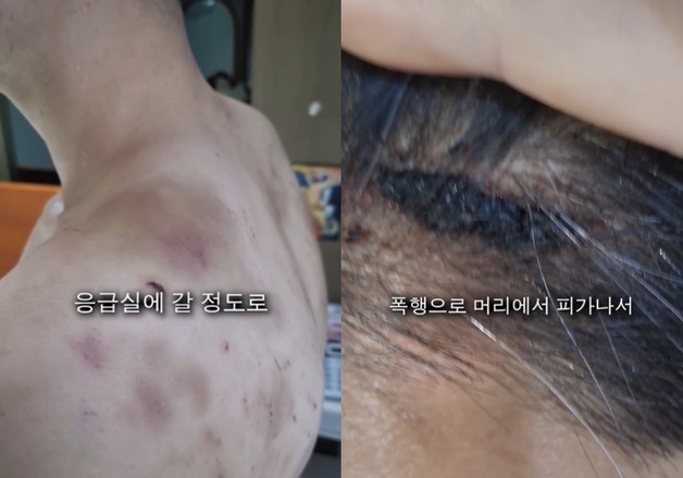 "도망치면 가족 죽일 것"…중국집 사장이 동갑내기 직원 수년간 감금·폭행