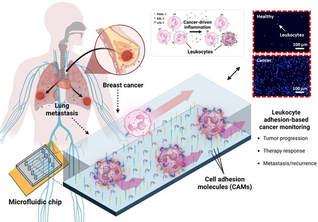 UNIST "백혈구 면역 반응으로 암 재발 진단하는 칩 개발"