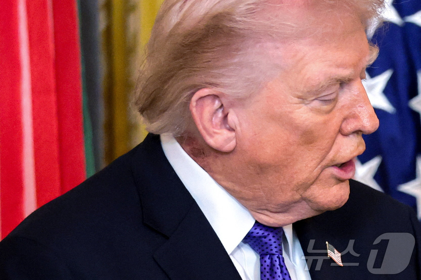 (워싱턴DC 로이터=뉴스1) 윤다정 기자 = 2일(현지시간) 미국 워싱턴 DC 백악관에서 열린 명예훈장 수여식에 참석한 도널드 트럼프 미국 대통령의 목덜미 위로 발진이 드러나 있다 …