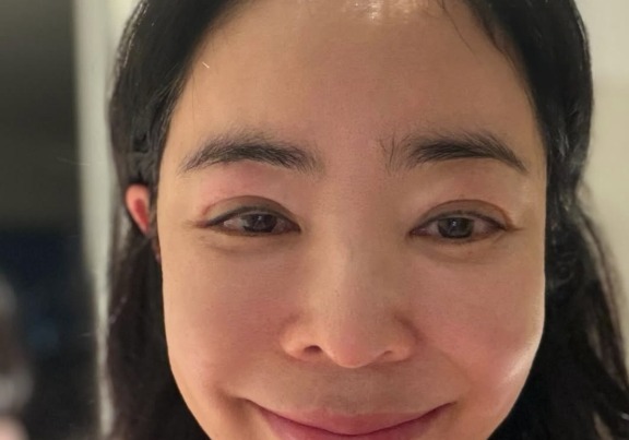 이혜영, 퉁퉁 부은 얼굴 왜? "전시회로 무리하며 심해져"[N샷]