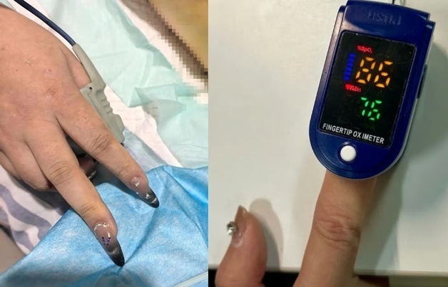 심장마비로 쓰러진 여성, 손톱 '이것' 때문에 죽을 뻔…무슨 일?