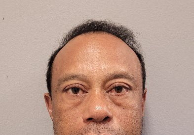 타이거 우즈, 약물운전 의심 체포 때 마약성 진통제 소지해