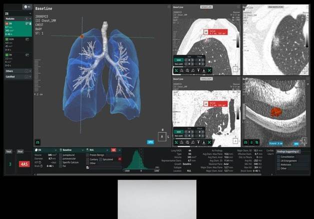 '1세대 의료 AI' 코어라인소프트, 유럽 성과로 '안정적 성장' 입증[문대현의 메디뷰]
