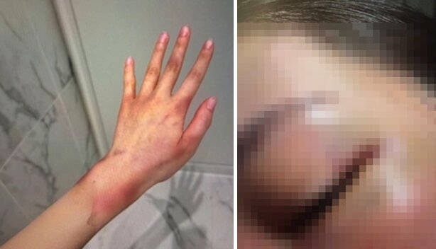 본문 이미지 - 온라인 커뮤니티