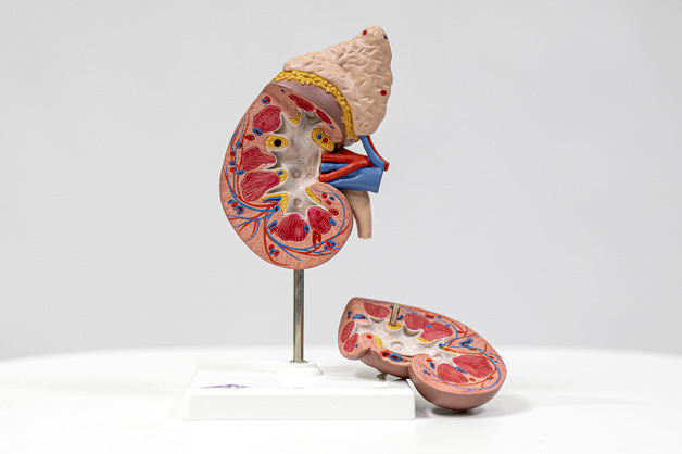 비알코올성 지방간, 신장암 위험 1.5배↑…비만 동반시 2.12배